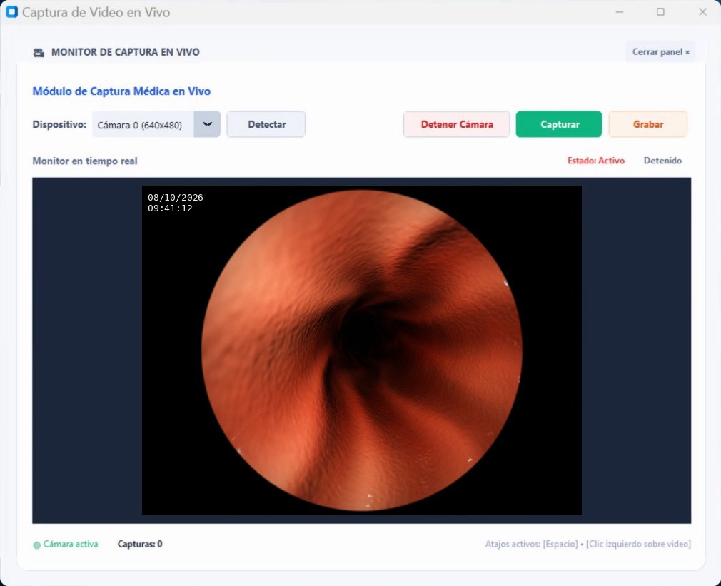Ventana de captura en vivo del sistema, con la imagen del endoscopio y los botones Capturar y Grabar